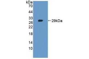 Western blot analysis of recombinant Human TNKS2. (TNKS2 Antikörper  (AA 959-1166))