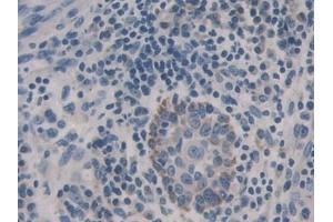Immunohistochemistry (IHC) image for anti-Cadherin-16 (CDH16) (AA 37-287) antibody (ABIN7434509)