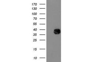 Western Blotting (WB) image for anti-NudE Nuclear Distribution E Homolog (A. Nidulans)-Like 1 (NDEL1) antibody (ABIN1499856) (NDEL1 Antikörper)