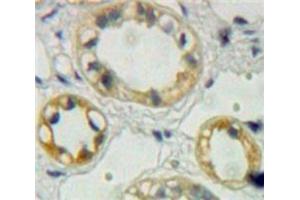 Immunohistochemistry (IHC) image for anti-Ephrin Type A Receptor 1 (EPHA1) (AA 716-960) antibody (ABIN1858726)