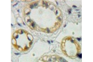 Used in DAB staining on fromalin fixed paraffin-embedded Kidney tissue (EPHA1 Antikörper  (AA 716-960))