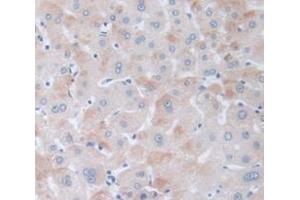 IHC-P analysis of Human Tissue, with DAB staining. (PPARD Antikörper  (AA 260-426))