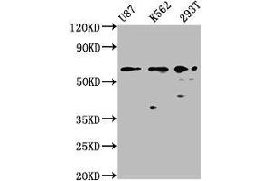 Western Blot Positive WB detected in: U87 whole cell lysate, K562 whole cell lysate, 293T whole cell lysate All lanes: ZNF37A antibody at 2. (ZNF37A Antikörper  (AA 263-386))