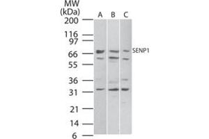 Western blot analysis of SENP1 in A) Daudi, B) HeLa and C) NIH/3T3 cell lysate. (SENP1 Antikörper  (AA 578-590))