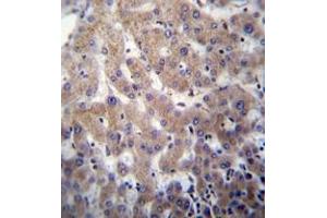 Immunohistochemistry analysis in formalin fixed and paraffin embedded human liver tissue reacted with POFUT2 Antibody (Center) followed which was peroxidase conjugated to the secondary antibody and followed by DAB staining. (POFUT2 Antikörper  (Middle Region))