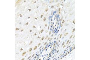 Immunohistochemistry of paraffin-embedded human esophagus using ELAC2 antibody (ABIN5974286) at dilution of 1/100 (40x lens). (ELAC2 Antikörper)