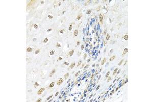 Immunohistochemistry of paraffin-embedded human esophagus using ELAC2 antibody (ABIN5974286) at dilution of 1/100 (40x lens). (ELAC2 Antikörper)