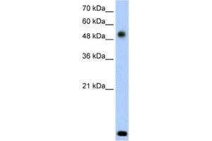 Western Blotting (WB) image for anti-Radical S-Adenosyl Methionine Domain Containing 2 (RSAD2) antibody (ABIN2462622) (RSAD2 Antikörper)