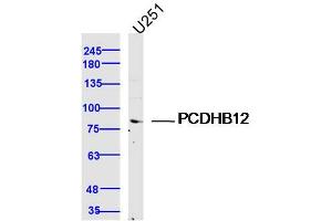 U251 lysates probed with PCDHB12 Polyclonal Antibody, Unconjugated  at 1:300 dilution and 4˚C overnight incubation. (PCDHB12 Antikörper  (AA 121-220))