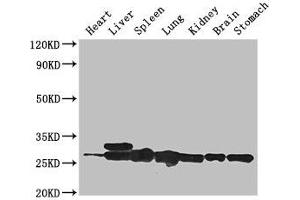 Western Blot Positive WB detected in: Mouse heart tissue, Mouse liver tissue, Mouse spleen tissue, Mouse lung tissue, Mouse kidney tissue, Mouse brain tissue, Mouse stomach tissue All lanes: SWI5 antibody at 3 μg/mL Secondary Goat polyclonal to rabbit IgG at 1/50000 dilution Predicted band size: 27 kDa Observed band size: 27, 29 kDa (SWI5 Antikörper  (AA 54-112))