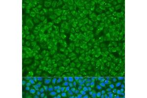 Immunofluorescence analysis of U2OS cells using GOSR1 Polyclonal Antibody at dilution of 1:100. (GS28 Antikörper)