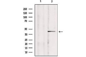 Western blot analysis of extracts from mouse brain, using CCDC109A Antibody. (MCU Antikörper  (Internal Region))