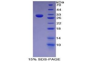 SDS-PAGE analysis of Mouse HAT1 Protein. (HAT1 Protein)