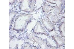 Immunohistochemistry (IHC) image for anti-Synaptotagmin Binding, Cytoplasmic RNA Interacting Protein (SYNCRIP) (AA 2-191) antibody (ABIN7155134)