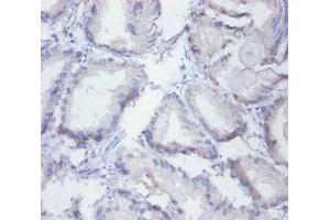 Immunohistochemistry of paraffin-embedded human prostate tissue using ABIN7155134 at dilution of 1:100 (SYNCRIP Antikörper  (AA 2-191))