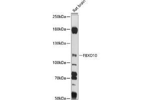 Western blot analysis of extracts of rat brain, using FBXO10 antibody (ABIN7267084) at 1:1000 dilution.