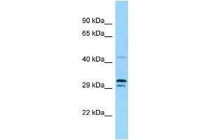 Western Blotting (WB) image for anti-Ubiquitin-Like Modifier Activating Enzyme 5 (UBA5) (N-Term) antibody (ABIN2783950)