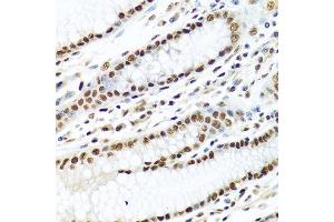 Immunohistochemistry of paraffin-embedded human stomach using METTL3 antibody at dilution of 1:100 (40x lens). (METTL3 Antikörper)