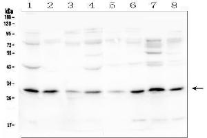 Western blot analysis of PEF1 using anti-PEF1 antibody (ABIN6719632).