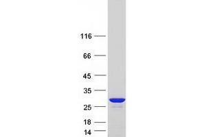 Validation with Western Blot (Peroxiredoxin 1 Protein (PRDX1) (Transcript Variant 3) (Myc-DYKDDDDK Tag))