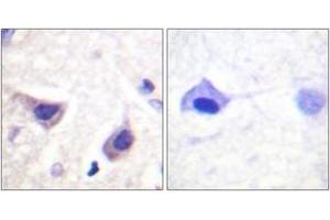 Immunohistochemistry analysis of paraffin-embedded human brain tissue, using JAK3 (Ab-785) Antibody. (JAK3 Antikörper  (AA 751-800))