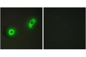 Immunofluorescence analysis of A549 cells, using Ik3-2 Antibody.