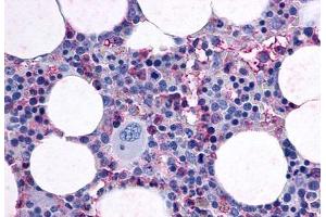 Anti-F2RL3 / PAR4 antibody  ABIN1048594 IHC staining of human bone marrow. (F2RL3 Antikörper  (Cytoplasmic Domain))