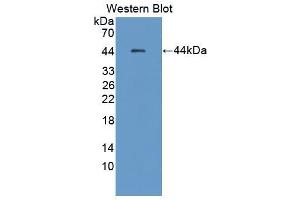 Western blot analysis of the recombinant protein. (HSF4 Antikörper  (AA 171-284))