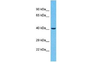 Host:  Rabbit  Target Name:  ZNF232  Sample Type:  Breast Tumor lysates  Antibody Dilution:  1. (ZNF232 Antikörper  (C-Term))