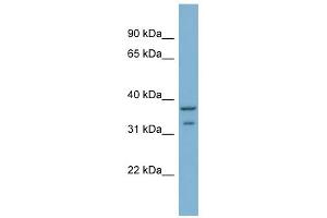 WB Suggested Anti-RALGPS2 Antibody Titration: 0. (RALGPS2 Antikörper  (C-Term))