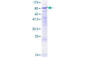 Acetylcholinesterase Protein (AChE) (AA 1-640) (GST tag)