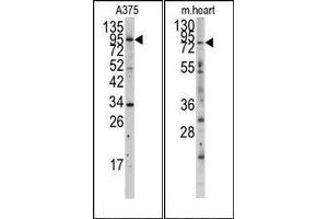 Image no. 1 for anti-Myosin Light Chain Kinase (MYLK) (N-Term) antibody (ABIN360382) (MYLK Antikörper  (N-Term))