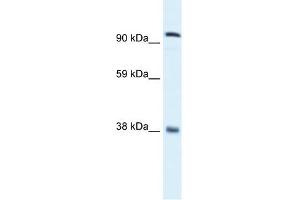 Western Blotting (WB) image for anti-MDS1 and EVI1 Complex Locus (MECOM) (C-Term) antibody (ABIN2777403)