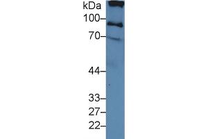 Western Blot; Sample: Human Serum; Primary Ab: 3µg/ml Rabbit Anti-Human ITIH2 Antibody Second Ab: 0. (ITIH2 Antikörper  (AA 452-702))