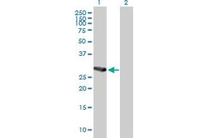 Western Blot analysis of C21orf7 expression in transfected 293T cell line by C21orf7 MaxPab polyclonal antibody. (MAP3K7CL Antikörper  (AA 1-242))