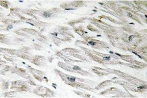 Immunohistochemistry (IHC) analyzes of CPI-17 antibody in paraffin-embedded human heart tissue. (CPI-17 Antikörper)