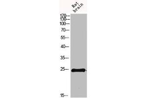 Western blot analysis of 293T Hela VEC KB mouse-kidney lysate, antibody was diluted at 500. (IL-19 Antikörper  (AA 51-100))