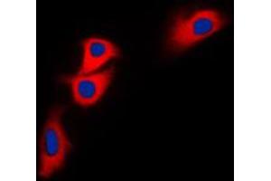 Immunofluorescent analysis of BNIP2 staining in HEK293T cells. (BNIP2 Antikörper  (C-Term))