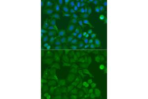 Immunofluorescence analysis of A549 cells using SSX5 antibody. (SSX5 Antikörper)