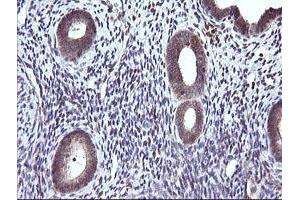 Image no. 6 for anti-Cancer/testis Antigen 1B (CTAG1B) antibody (ABIN1499894) (CTAG1B Antikörper)