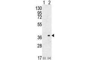 Western Blotting (WB) image for anti-Major Histocompatibility Complex, Class II, DQ alpha 1 (HLA-DQA1) (AA 39-66) antibody (ABIN3031680)