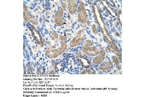 Rabbit Anti-CYP2D6 Antibody  Paraffin Embedded Tissue: Human Kidney Cellular Data: Epithelial cells of renal tubule Antibody Concentration: 4. (CYP2D6 Antikörper  (N-Term))