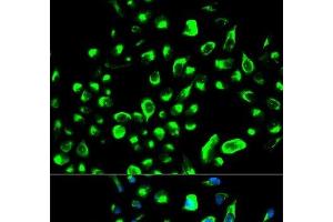 Immunofluorescence analysis of HeLa cells using YWHAQ Polyclonal Antibody (14-3-3 theta Antikörper)