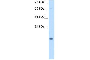 WB Suggested Anti-CSTB Antibody Titration:  0. (CSTB Antikörper  (N-Term))
