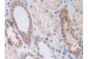DAB staining on IHC-P; Samples: Human Kidney Tissue (PPIF Antikörper  (AA 45-196))