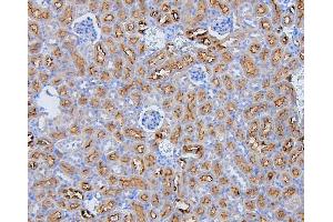 IHC analysis of SLC9A3R1 using anti-SLC9A3R1 antibody (ABIN6719642).