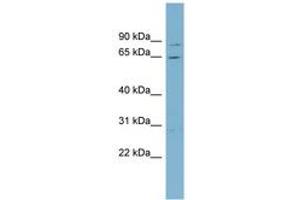 Image no. 1 for anti-Replication Protein A1, 70kDa (RPA1) (AA 215-264) antibody (ABIN6742105) (RPA1 Antikörper  (AA 215-264))