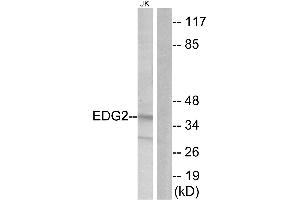 Immunohistochemistry analysis of paraffin-embedded human brain tissue using EDG2 antibody. (BUD31 Antikörper  (Internal Region))