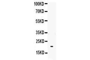 Western blot analysis of IL-6 using anti- IL-6 antibody . (IL-6 Antikörper  (AA 29-212))