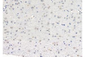 ABIN6265048 and ABIN6279809 at 1/100 staining Rat brain tissue by IHC-P. (SH2B3 Antikörper  (N-Term))